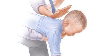 Bé gái 2 tuổi tử vong do hóc hạt nhãn