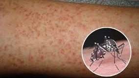 Đẩy mạnh tuyên truyền phòng, chống bệnh sốt xuất huyết