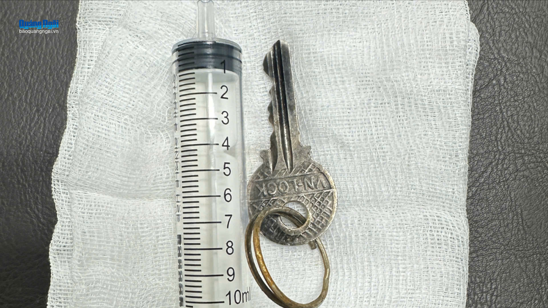 Gắp thành công chìa khóa trong dạ dày bé trai 14 tuổi