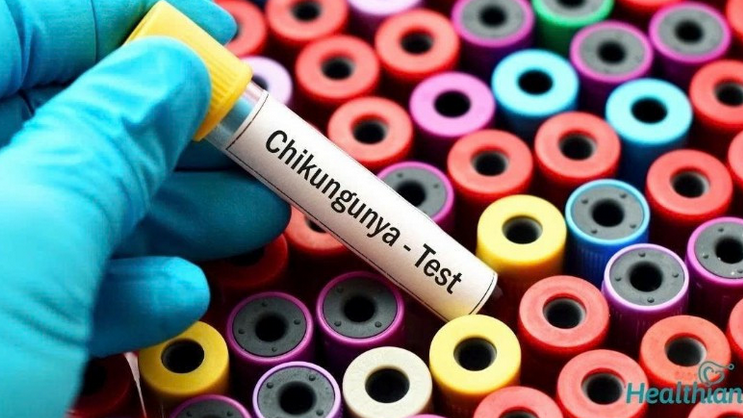 WHO cảnh báo nguy cơ lây lan cao của virus Chikungunya