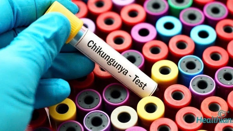 Bộ Y tế: Tăng cường giám sát dịch Chikungunya ngay tại cửa khẩu, cơ sở y tế