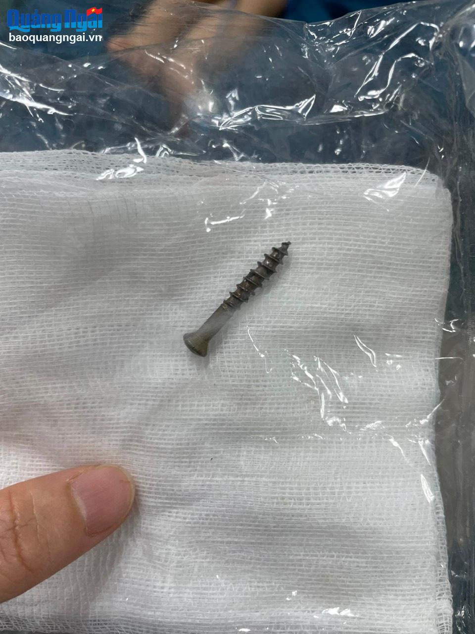 Gắp thành công dị vật trong đường tiêu hóa trẻ 2 tuổi