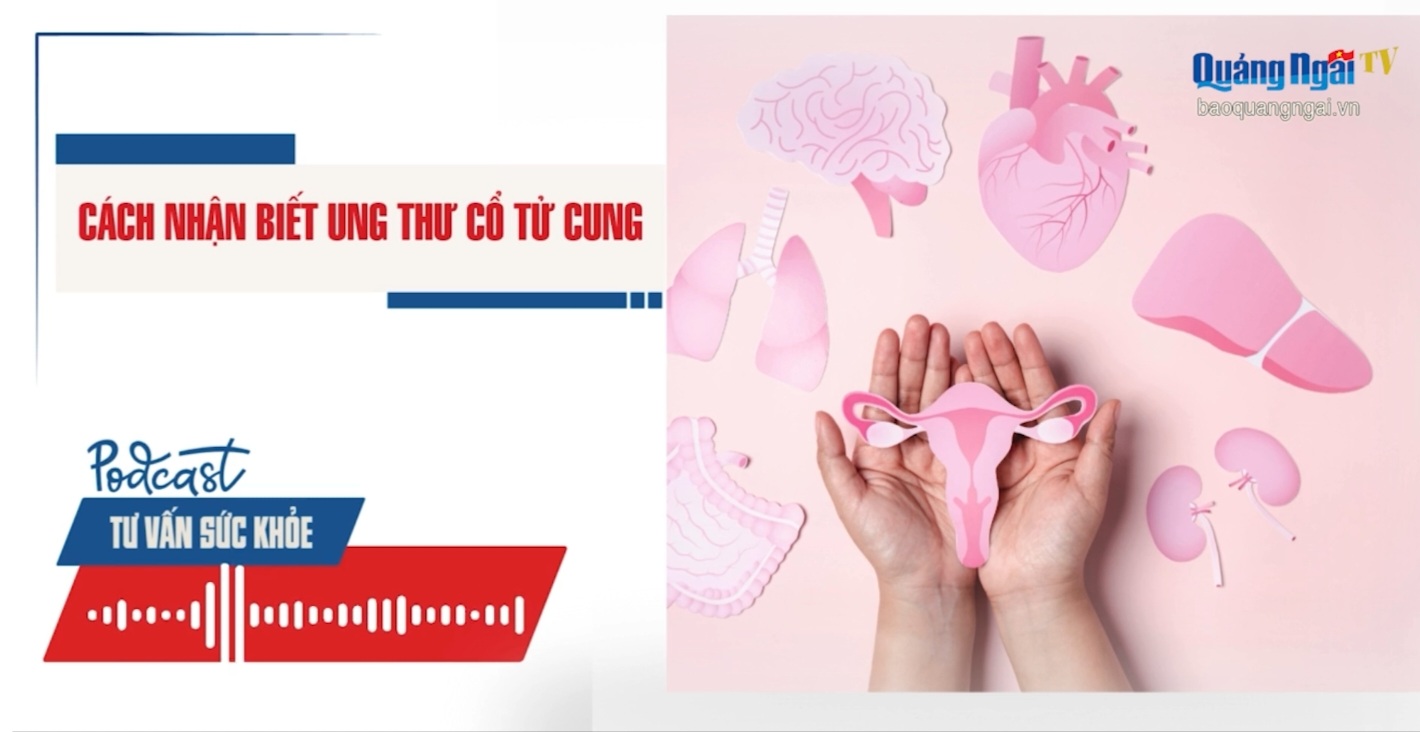 Podcast Tư vấn sức khỏe: Cách nhận biết ung thư cổ tử cung