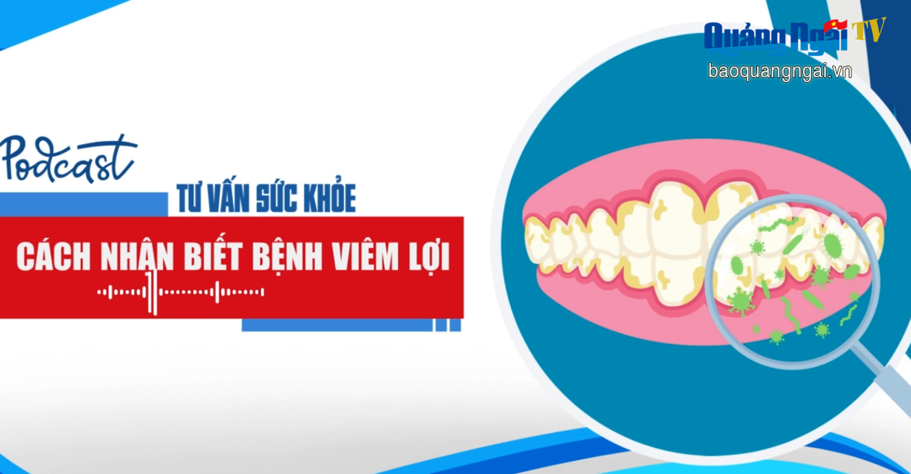 [Podcast]. Cách nhận biết bệnh viêm lợi