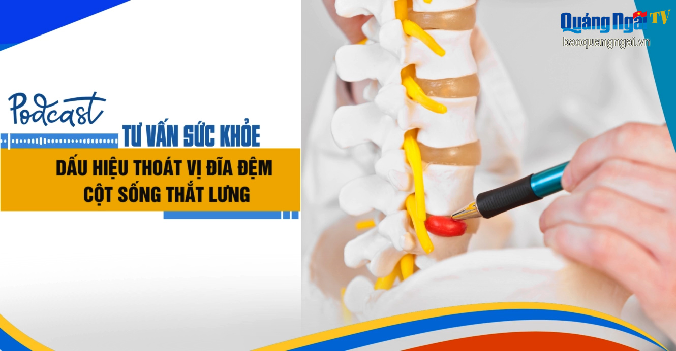 [Podcast]. Dấu hiệu thoát vị đĩa đệm cột sống thắt lưng