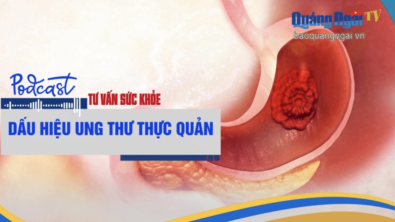 [Podcast]. Dấu hiệu ung thư thực quản