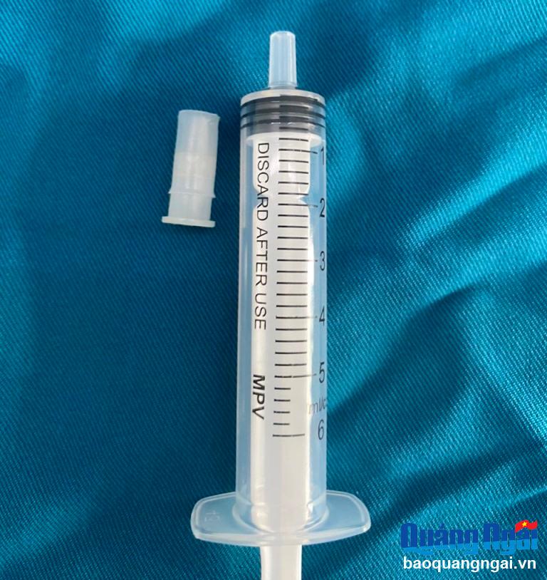 Gắp thành công dị vật trong đường thở một bệnh nhi