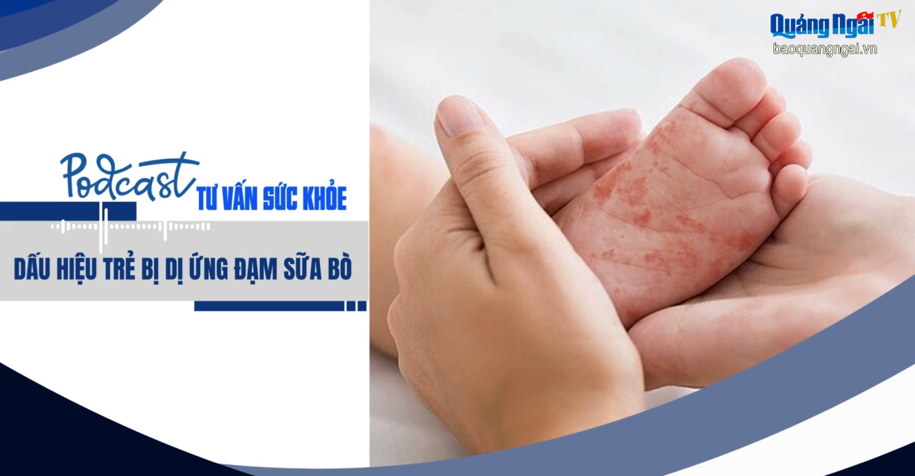 [Podcast]. Dấu hiệu trẻ bị dị ứng đạm sữa bò
