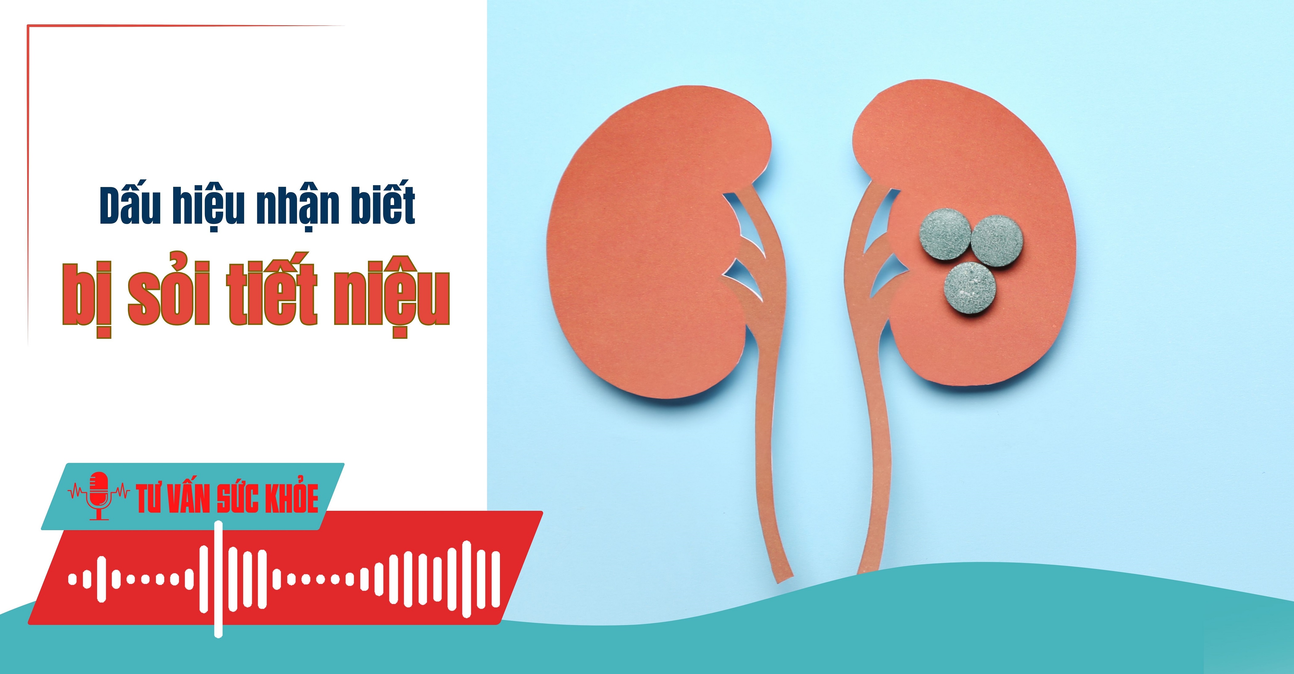 Podcast Tư vấn sức khỏe:  Dấu hiệu nhận biết bị sỏi tiết niệu