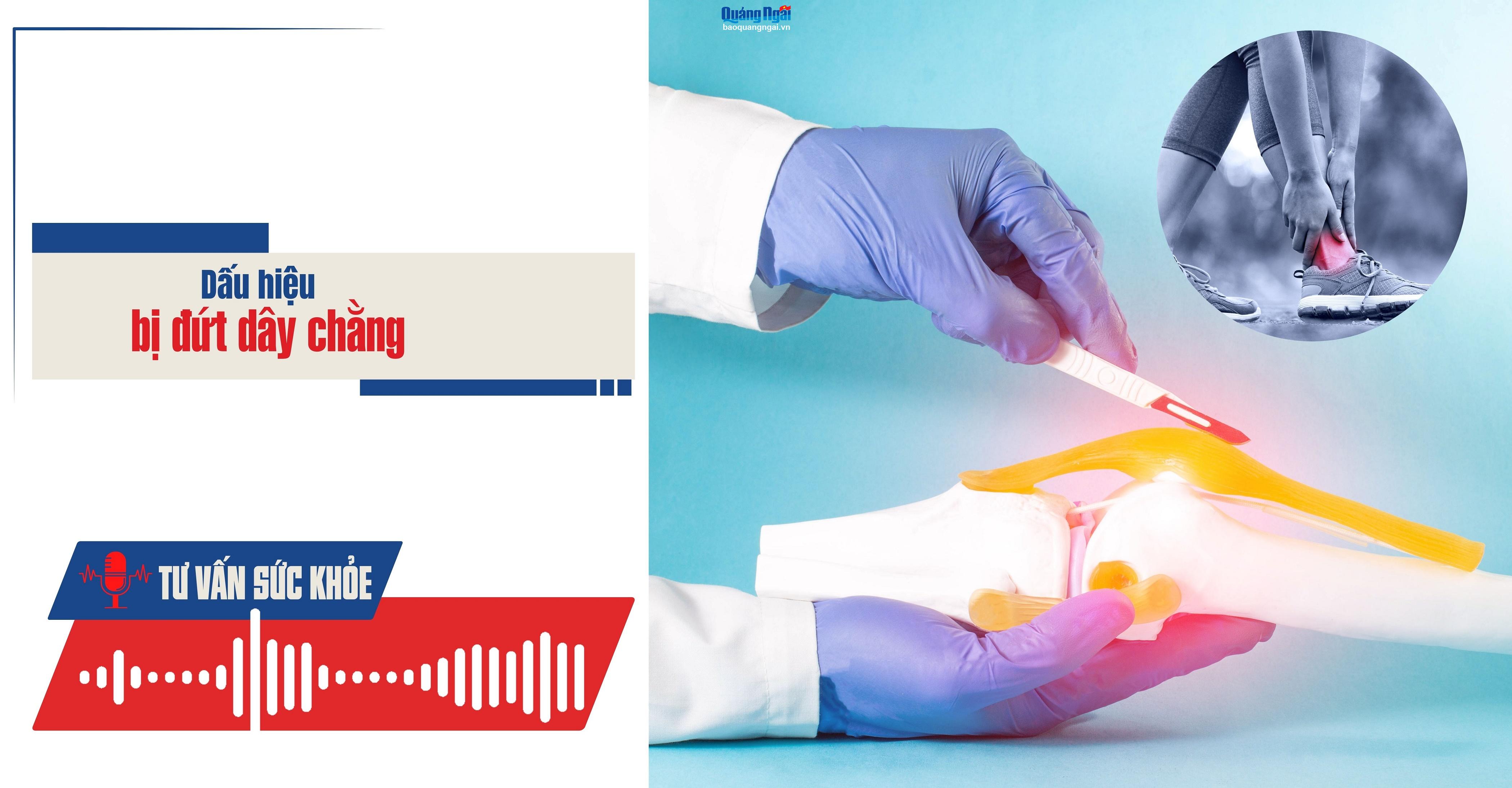 Podcast Tư vấn sức khỏe: Dấu hiệu bị đứt dây chằng
