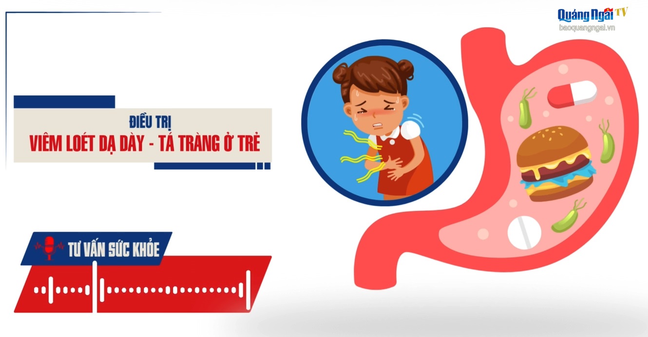 Podcast Tư vấn sức khỏe: Điều trị viêm loét dạ dày – tá tràng ở trẻ